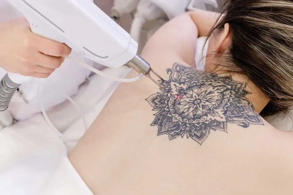 A woman undergoing a cosmetic tattoo procedure on their back.