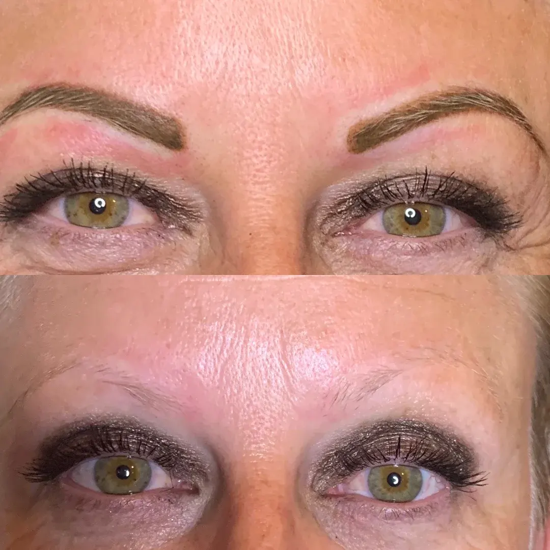 Eyebrow Services Before and After Image (1)